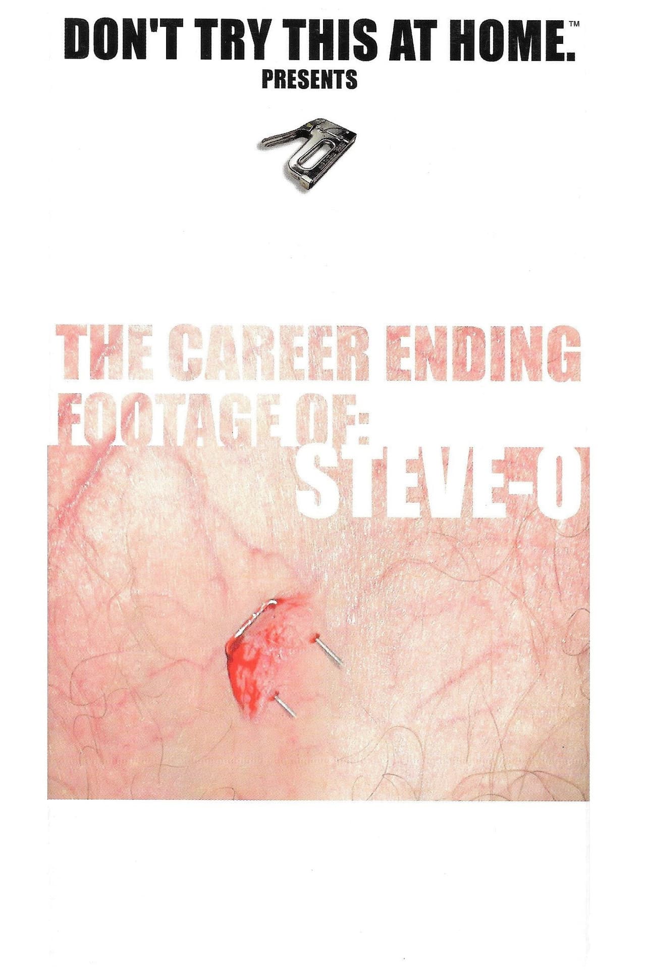 The Career Ending Footage of: Steve-O preview 1